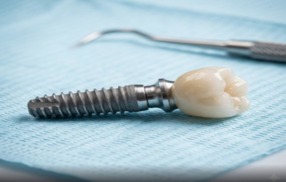 A close-up of a high-quality titanium dental implant with a ceramic crown resting on a light blue clinical tray at Yoha Dental Clinic.